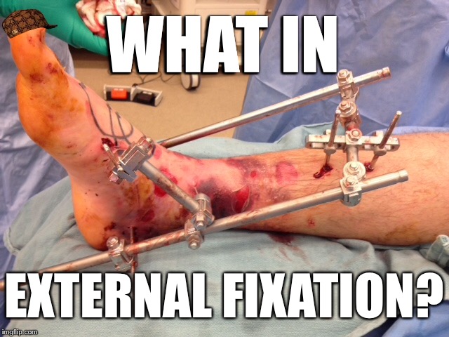 WHAT IN; EXTERNAL FIXATION? | image tagged in what in tarnation week,what in tarnation | made w/ Imgflip meme maker