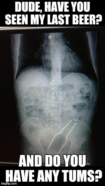 image tagged in funny,fails,xray | made w/ Imgflip meme maker
