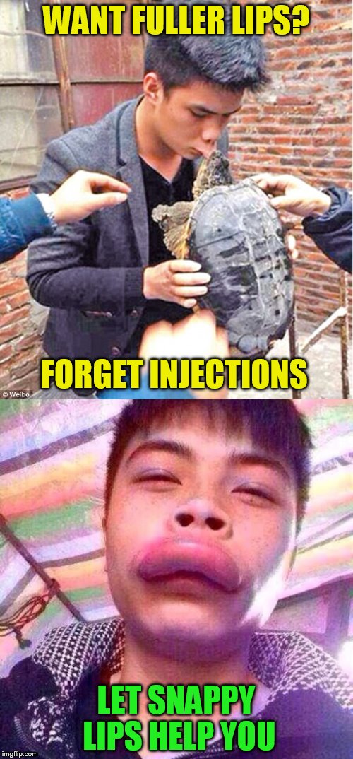 WANT FULLER LIPS? LET SNAPPY LIPS HELP YOU FORGET INJECTIONS | made w/ Imgflip meme maker