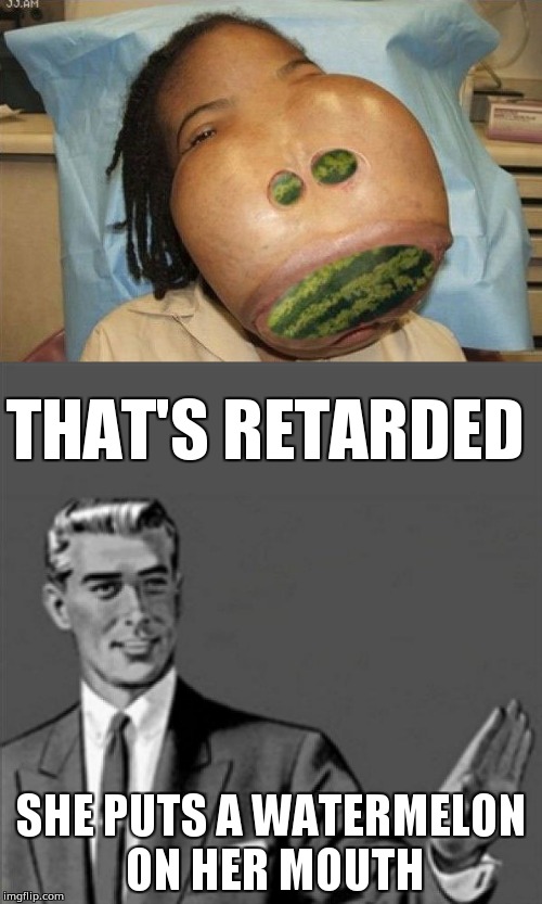 Correction Guy is disgusted about Girl putting watermelon on her mouth | THAT'S RETARDED; SHE PUTS A WATERMELON ON HER MOUTH | image tagged in correction guy,kill yourself guy | made w/ Imgflip meme maker