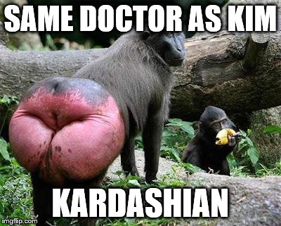 Baboon Butt | SAME DOCTOR AS KIM; KARDASHIAN | image tagged in baboon butt | made w/ Imgflip meme maker