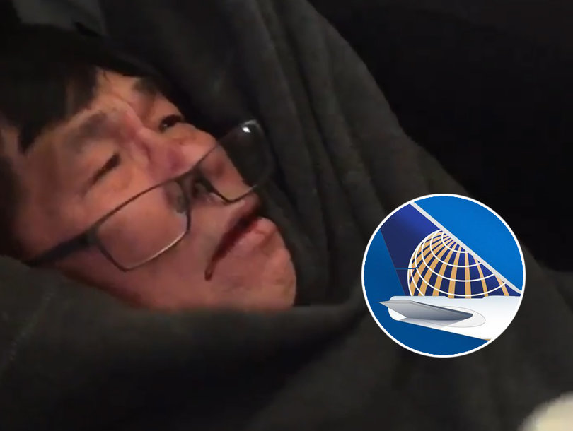 United Airline Bloodied Passenger Blank Meme Template