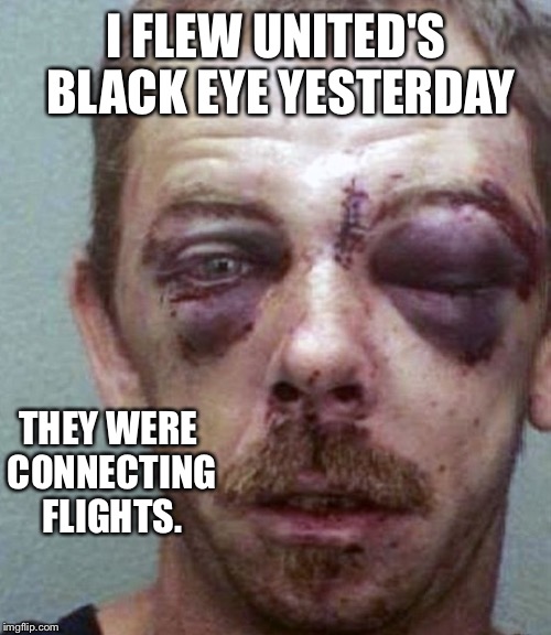 I FLEW UNITED'S BLACK EYE YESTERDAY THEY WERE CONNECTING FLIGHTS. | made w/ Imgflip meme maker