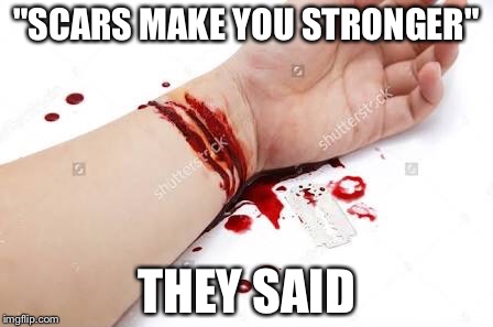 Happiness  | "SCARS MAKE YOU STRONGER"; THEY SAID | image tagged in memes,funny,funny memes,suicide,best meme | made w/ Imgflip meme maker