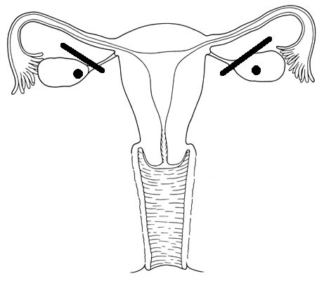 Ovaries Triggered! Blank Meme Template