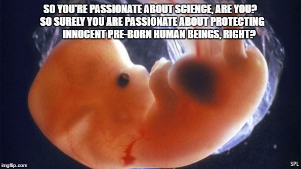Passionate About Science? | SO YOU'RE PASSIONATE ABOUT SCIENCE, ARE YOU?  SO SURELY YOU ARE PASSIONATE ABOUT PROTECTING         INNOCENT PRE-BORN HUMAN BEINGS, RIGHT? | image tagged in fetus,science,pro-life,abortion | made w/ Imgflip meme maker