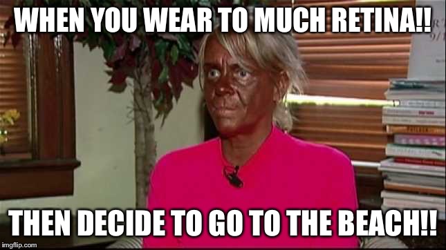 Sunburn | WHEN YOU WEAR TO MUCH RETINA!! THEN DECIDE TO GO TO THE BEACH!! | image tagged in sunburn | made w/ Imgflip meme maker