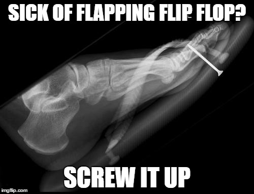 Flip Flop Anti-Flap | SICK OF FLAPPING FLIP FLOP? SCREW IT UP | image tagged in x-ray,flipflop,screwed up | made w/ Imgflip meme maker