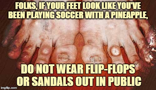 Ugly Feet | FOLKS, IF YOUR FEET LOOK LIKE YOU'VE BEEN PLAYING SOCCER WITH A PINEAPPLE, DO NOT WEAR FLIP-FLOPS OR SANDALS OUT IN PUBLIC | image tagged in ugly feet,flipflop,funny,funny memes | made w/ Imgflip meme maker