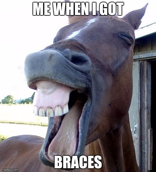 Funny Horse Face | ME WHEN I GOT; BRACES | image tagged in funny horse face | made w/ Imgflip meme maker