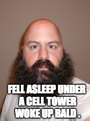  FELL ASLEEP UNDER A CELL TOWER WOKE UP BALD . | image tagged in bald smart | made w/ Imgflip meme maker