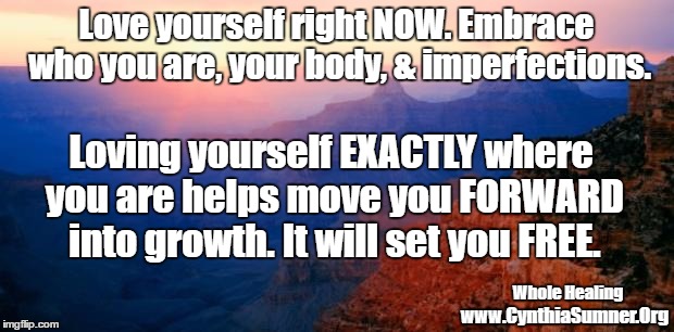 motivation | Love yourself right NOW. Embrace who you are, your body, & imperfections. Loving yourself EXACTLY where you are helps move you FORWARD into growth. It will set you FREE. Whole Healing; www.CynthiaSumner.Org | image tagged in motivation | made w/ Imgflip meme maker