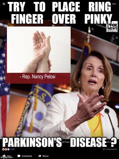 contortionist in congress | TRY    TO   PLACE    RING  FINGER    OVER    PINKY; PARKINSON'S    DISEASE  ? | image tagged in nancy pelosi | made w/ Imgflip meme maker