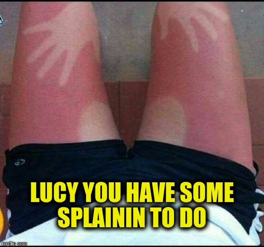 Someone had a nice time on the Beach | LUCY YOU HAVE SOME SPLAININ TO DO | image tagged in memes,believe it or not,sunburn meme,son of a beach | made w/ Imgflip meme maker