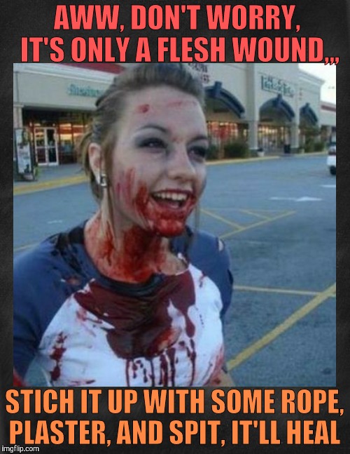 Crazy nympho with added background,,, | AWW, DON'T WORRY,      IT'S ONLY A FLESH WOUND,,, STICH IT UP WITH SOME ROPE, PLASTER, AND SPIT, IT'LL HEAL | image tagged in crazy nympho with added background   | made w/ Imgflip meme maker