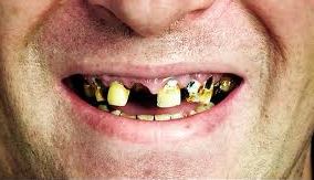 Rotten teeth Blank Meme Template