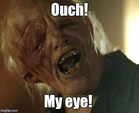r2dxk.jpg | Ouch! My eye! | image tagged in r2dxkjpg | made w/ Imgflip meme maker
