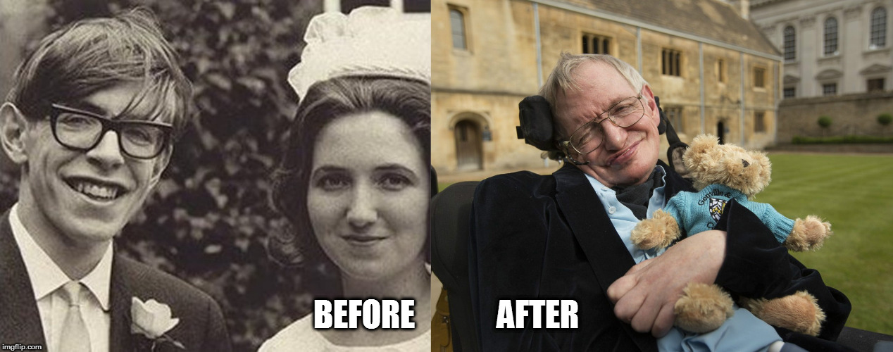 BEFORE             AFTER | image tagged in kedar joshi,stephen hawking,before and after | made w/ Imgflip meme maker