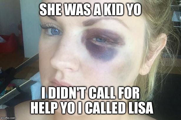SHE WAS A KID YO; I DIDN'T CALL FOR HELP YO I CALLED LISA | image tagged in black eye | made w/ Imgflip meme maker