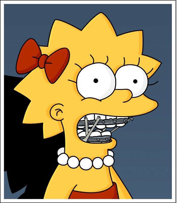 Lisa braces Blank Meme Template