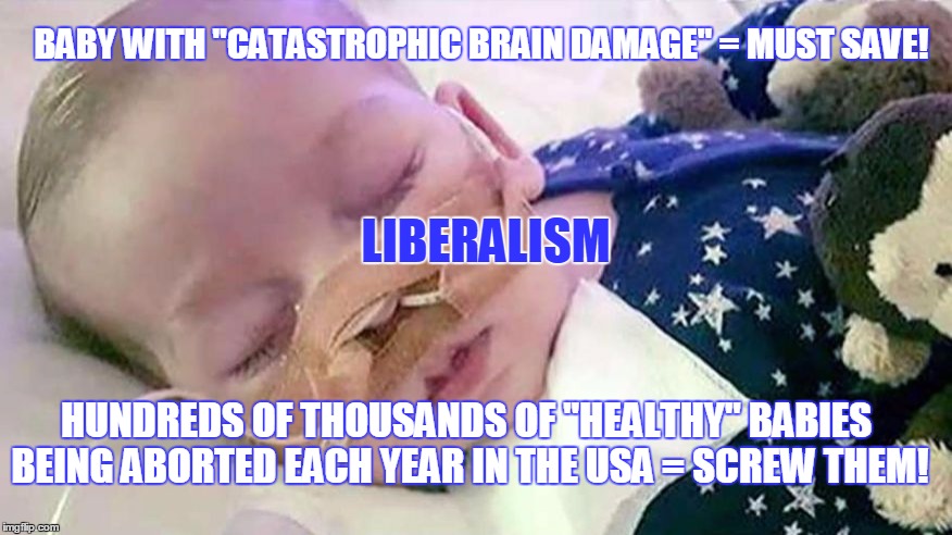 Why Liberalism Makes Me SMH | BABY WITH "CATASTROPHIC BRAIN DAMAGE" = MUST SAVE! LIBERALISM; HUNDREDS OF THOUSANDS OF "HEALTHY" BABIES BEING ABORTED EACH YEAR IN THE USA = SCREW THEM! | image tagged in liberalism,abortion,smh | made w/ Imgflip meme maker