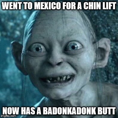 Gollum | WENT TO MEXICO FOR A CHIN LIFT; NOW HAS A BADONKADONK BUTT | image tagged in memes,gollum | made w/ Imgflip meme maker