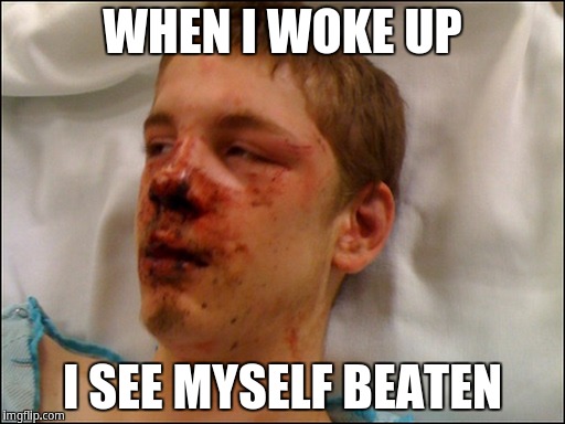 When i woke up, i see myself beaten | WHEN I WOKE UP; I SEE MYSELF BEATEN | image tagged in beat up guy | made w/ Imgflip meme maker