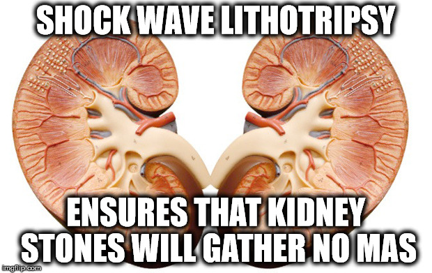 SHOCK WAVE LITHOTRIPSY; ENSURES THAT KIDNEY STONES
WILL GATHER NO MAS | image tagged in shockwavelithotripsy | made w/ Imgflip meme maker