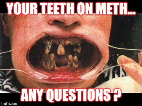 Your Teeth On Meth | YOUR TEETH ON METH... ANY QUESTIONS ? | image tagged in loyalsockatxhamster,meth | made w/ Imgflip meme maker