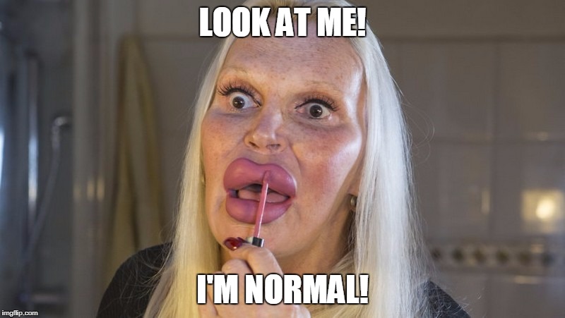 Transgender is Normal? | LOOK AT ME! I'M NORMAL! | image tagged in trans is normal,transgender,seriously wtf,liberal logic,libtards,gender identity | made w/ Imgflip meme maker