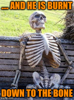 Waiting Skeleton Meme | .... AND HE IS BURNT DOWN TO THE BONE | image tagged in memes,waiting skeleton | made w/ Imgflip meme maker