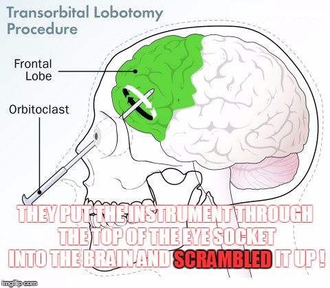 THEY PUT THE INSTRUMENT THROUGH THE TOP OF THE EYE SOCKET INTO THE BRAIN AND SCRAMBLED IT UP ! SCRAMBLED | made w/ Imgflip meme maker
