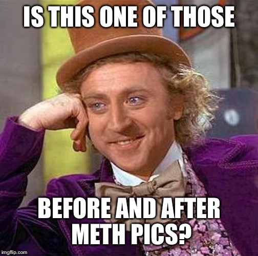 Creepy Condescending Wonka Meme | IS THIS ONE OF THOSE BEFORE AND AFTER METH PICS? | image tagged in memes,creepy condescending wonka | made w/ Imgflip meme maker