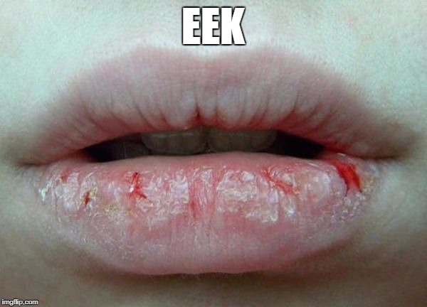 ENJOY THE EEK LIPS | EEK | image tagged in eclipse,puns,lips | made w/ Imgflip meme maker