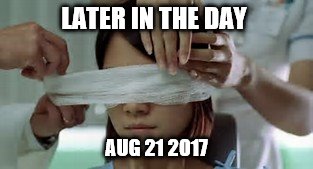 I cant see you  | LATER IN THE DAY; AUG 21 2017 | image tagged in eyes,bandages,blind | made w/ Imgflip meme maker