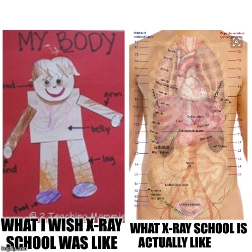 X-Ray School | WHAT X-RAY SCHOOL IS ACTUALLY LIKE; WHAT I WISH X-RAY SCHOOL WAS LIKE | image tagged in xray,student | made w/ Imgflip meme maker