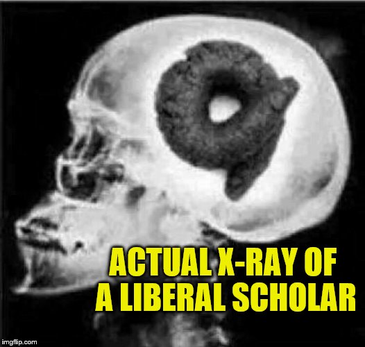 Turd Brain X-Ray of a Liberal Scholar | ACTUAL X-RAY OF A LIBERAL SCHOLAR | image tagged in liberals,memes,funny memes,liberal logic,turd brain liberals | made w/ Imgflip meme maker
