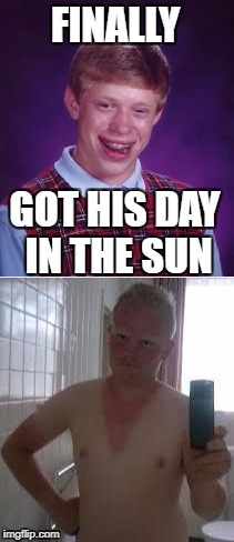 Bad Luck Brian | FINALLY; GOT HIS DAY IN THE SUN | image tagged in bad luck brian,sunburn | made w/ Imgflip meme maker