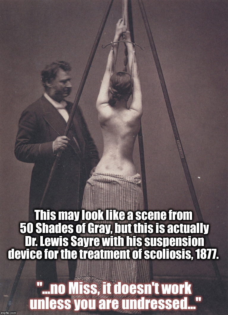 Suspension Device For The Treatment Of Scoliosis, 1877.  | This may look like a scene from 50 Shades of Gray, but this is actually Dr. Lewis Sayre with his suspension device for the treatment of scoliosis, 1877. "...no Miss, it doesn't work unless you are undressed..." | image tagged in 50 shades of grey,scoliosis,medical history,history of medicine | made w/ Imgflip meme maker