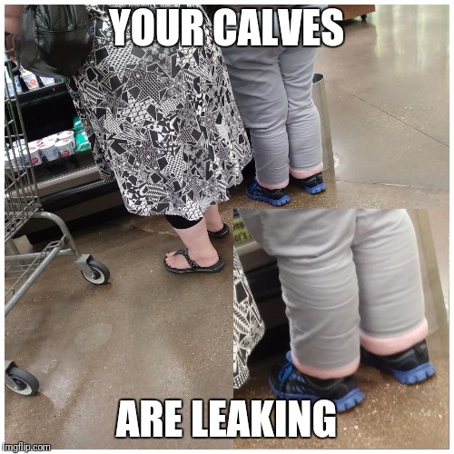 YOUR CALVES; ARE LEAKING | image tagged in people of walmart,fat,obesity,omg,wtf,funny | made w/ Imgflip meme maker