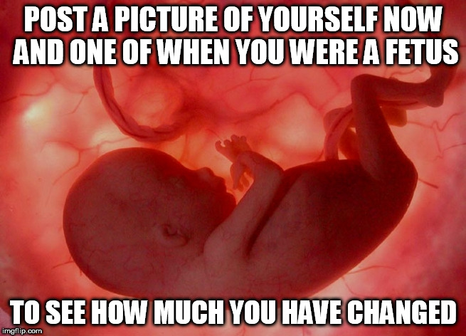 facebook | POST A PICTURE OF YOURSELF NOW AND ONE OF WHEN YOU WERE A FETUS; TO SEE HOW MUCH YOU HAVE CHANGED | image tagged in fetus,facebook,selfie,selfies,posts,pictures | made w/ Imgflip meme maker