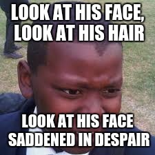 Ugly Boy | LOOK AT HIS FACE, LOOK AT HIS HAIR; LOOK AT HIS FACE SADDENED IN DESPAIR | image tagged in hairline fail | made w/ Imgflip meme maker