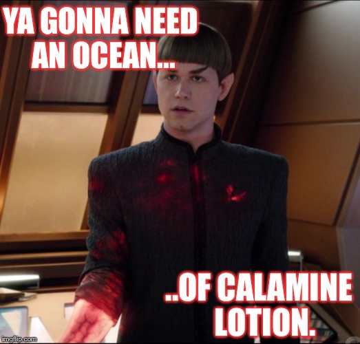 Vulcan Calamine Lotion | YA GONNA NEED AN OCEAN... ..OF CALAMINE 
LOTION. | image tagged in vulcan,calamine lotion,suicide bomber,star trek,star trek discovery | made w/ Imgflip meme maker