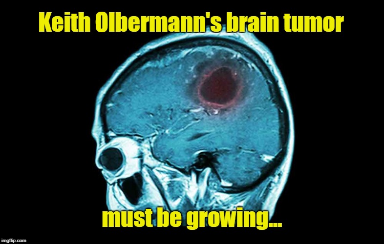 Keith Olbermann's brain tumor | Keith Olbermann's brain tumor; must be growing... | image tagged in brain tumor,keith olbermann,liberals | made w/ Imgflip meme maker