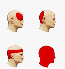 Headache Blank Template Imgflip