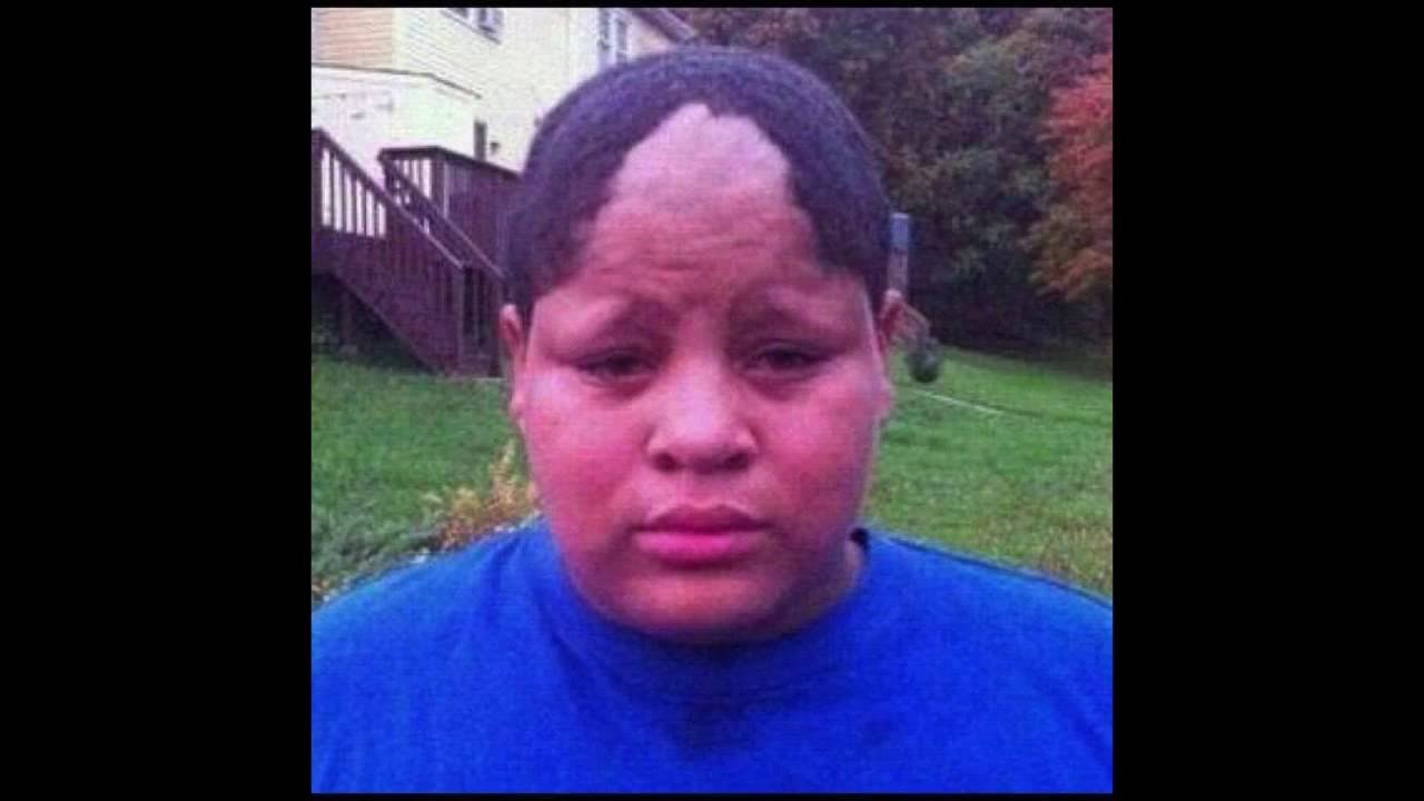 Ugly Hairline Blank Template Imgflip