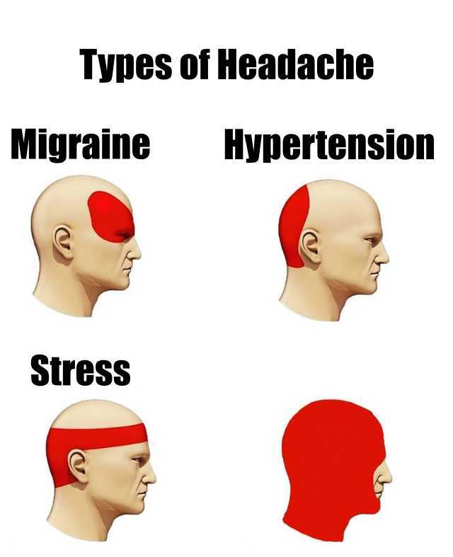 Types of Headache Blank Meme Template