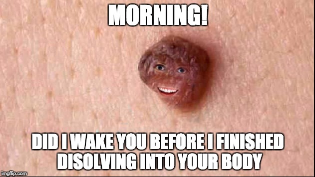 Overly Attached Wart | MORNING! DID I WAKE YOU BEFORE I FINISHED DISOLVING INTO YOUR BODY | image tagged in overly attached wart,meme | made w/ Imgflip meme maker