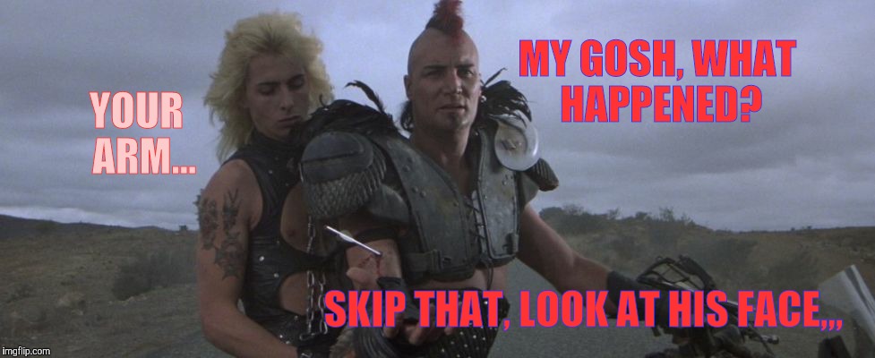 Wez ain't got a problem with that | MY GOSH, WHAT HAPPENED? YOUR  ARM... SKIP THAT, LOOK AT HIS FACE,,, | image tagged in wez ain't got a problem with that | made w/ Imgflip meme maker