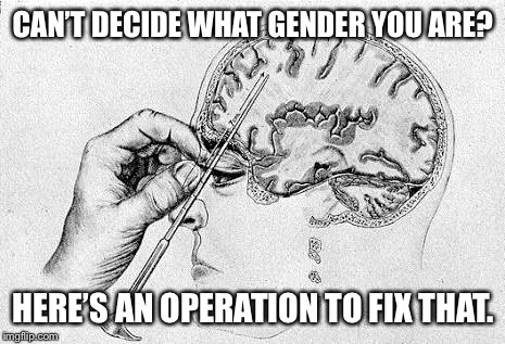 Lobotomy  | CAN’T DECIDE WHAT GENDER YOU ARE? HERE’S AN OPERATION TO FIX THAT. | image tagged in lobotomy | made w/ Imgflip meme maker